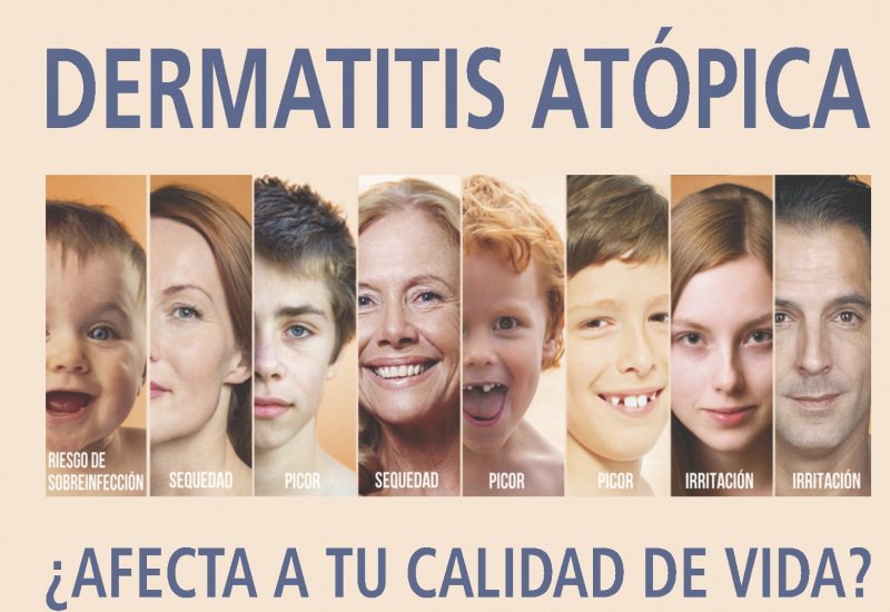 NP dermatitis